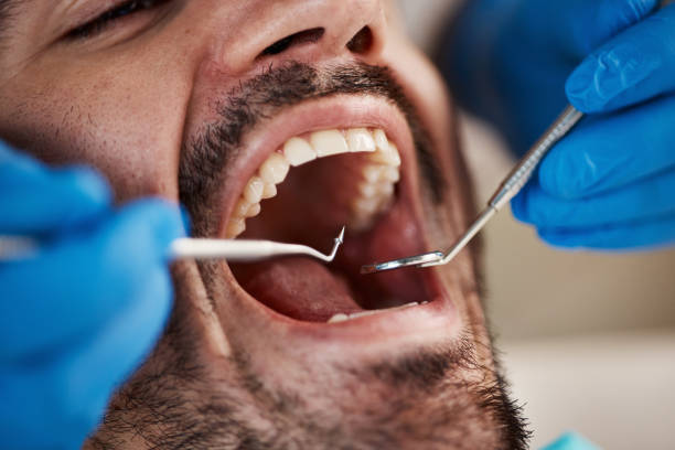 Best Emergency Tooth Extraction  in Skiato, OK